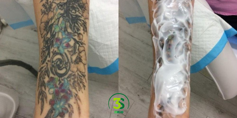 How to Apply Numbing Cream Before a Tattoo